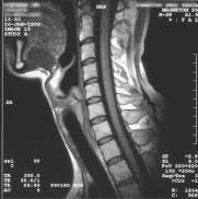 MRI scan 13, Nek